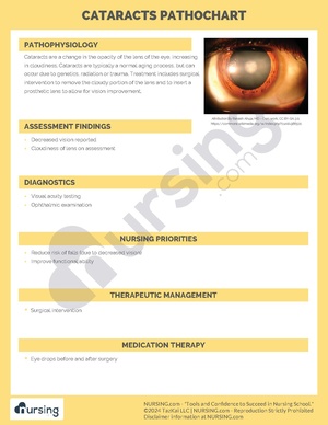 Cataracts Pathochart.pdf
