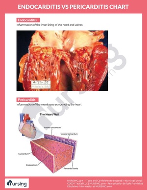 Endocarditis vs Pericarditis Chart.pdf