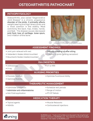 Osteoarthritis Pathochart.pdf