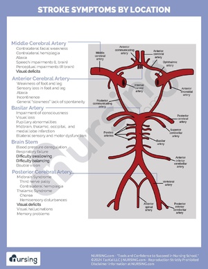 Stroke Locations.pdf