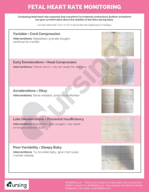 Fetal Heart Rate Monitoring.pdf