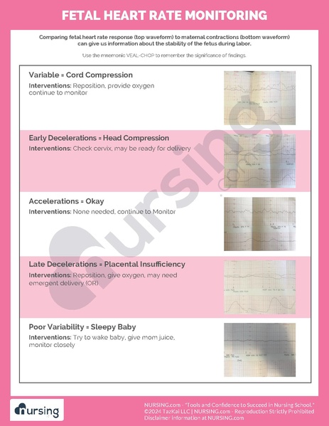 File:Fetal Heart Rate Monitoring.pdf