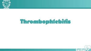 Thrombophlebitis – Virchow’s Triad.pdf