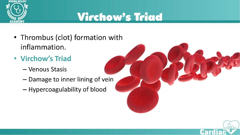 File:Thrombophlebitis – Virchow’s Triad.pdf