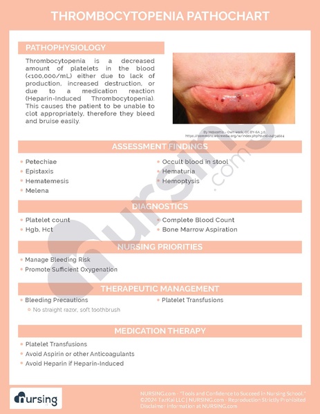 File:Thrombocytopenia Pathochart.pdf