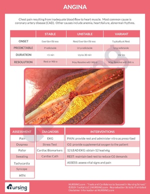 Angina.pdf