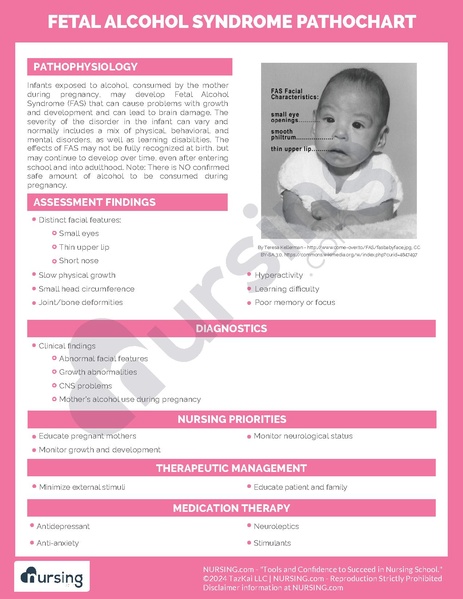 File:Fetal Alcohol Syndrome Pathochart.pdf