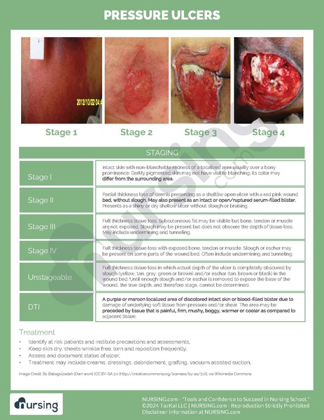 File:Pressure Ulcer Staging.pdf
