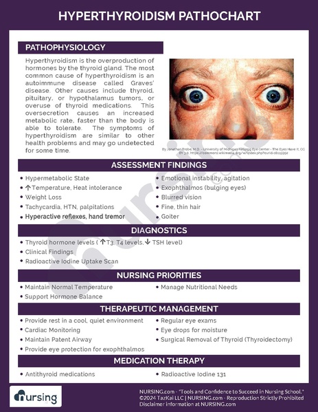 File:Hyperthyroidism Pathochart.pdf