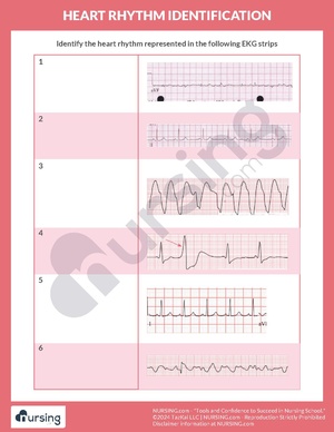 Heart Rhythm Identification.pdf