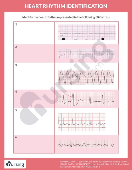 File:Heart Rhythm Identification.pdf