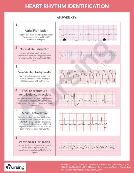 File:Heart Rhythm Identification.pdf