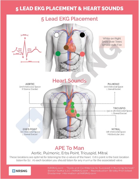 File:5 Lead EKG Placement.pdf