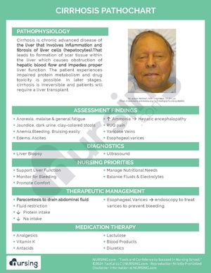 Cirrhosis Pathochart.pdf