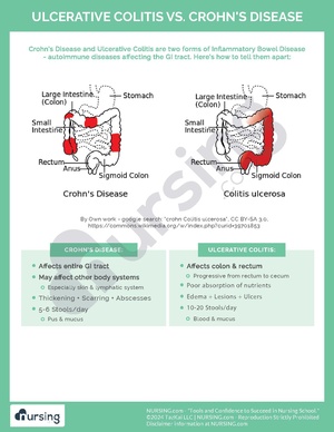 Ulcerative Colitis vs. Crohn’s Disease.pdf