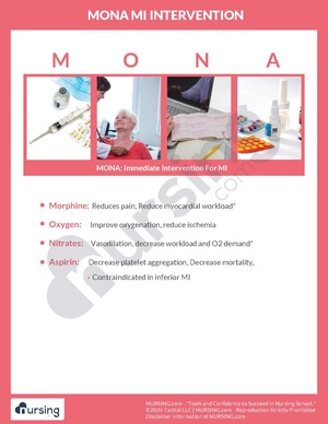 MONA MI Intervention.pdf