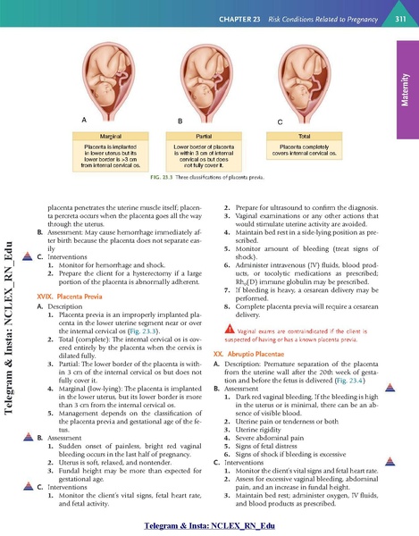 File:Saunders Comprehensive Review for the NCLEX-RN Examination 9th Edition.pdf