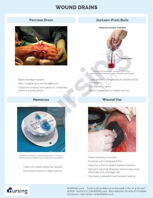 Wound Drains.pdf