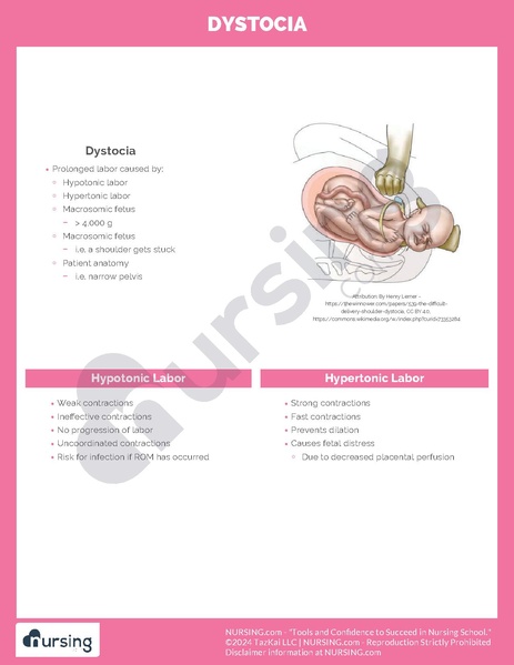 File:Dystocia.pdf