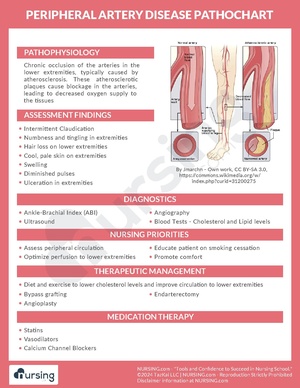 Peripheral Artery Disease Pathochart.pdf