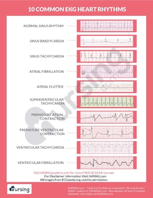 10 Common EKG Heart Rhythms.pdf