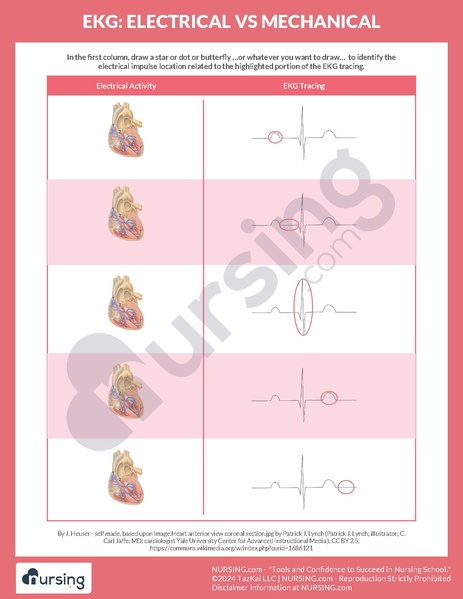 File:EKG Electrical vs Mechanical Worksheet.pdf