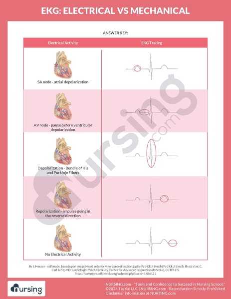 File:EKG Electrical vs Mechanical Worksheet.pdf