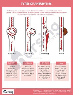 Types of Aneurysms.pdf