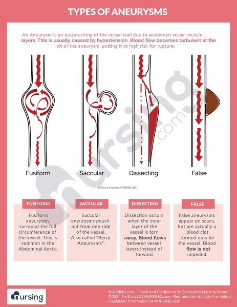 File:Types of Aneurysms.pdf
