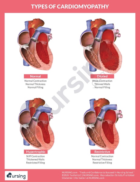 File:Types of Cardiomyopathy Chart.pdf
